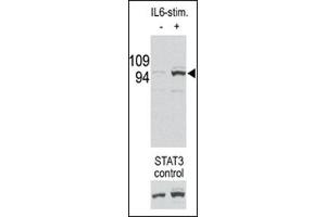 Image no. 1 for anti-Signal Transducer and Activator of Transcription 3 (Acute-Phase Response Factor) (STAT3) (pSer727) antibody (ABIN358233) (STAT3 抗体  (pSer727))