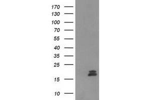 Western Blotting (WB) image for anti-Chromosome 2 Open Reading Frame 40 (C2orf40) antibody (ABIN1497049) (C2orf40 抗体)