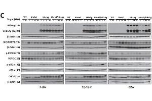 Western Blotting (WB) image for anti-Hepatitis B Virus Surface Antigen (HBsAg) antibody (ABIN285516)