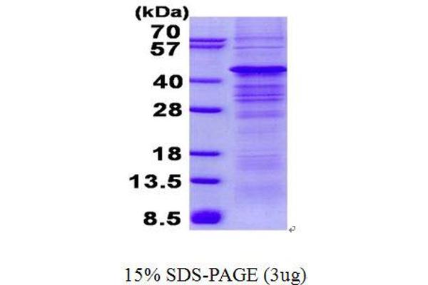 PRKAB1 Protein (His tag)