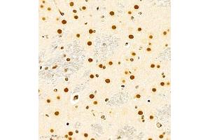 Immunohistochemistry of paraffin embedded rat brain using RB1 (ABIN7075477) at dilution of 1:700 (400x lens)