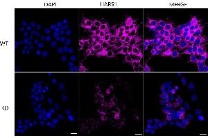 anti-Histidine--tRNA Ligase (HARS-1) antibody