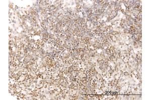 Immunoperoxidase of monoclonal antibody to STAT5B on formalin-fixed paraffin-embedded human lymph node. (STAT5B 抗体  (AA 678-787))
