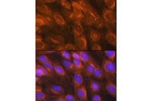 Immunofluorescence analysis of C6 cells using LM Rabbit pAb (ABIN6131613, ABIN6143266, ABIN6143267 and ABIN6214694) at dilution of 1:100 (40x lens). (LMAN1 抗体  (AA 270-480))
