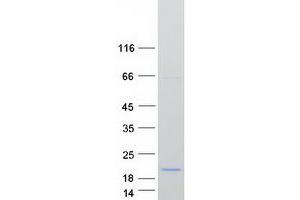 Western Blotting (WB) image for Programmed Cell Death 5 (PDCD5) protein (Myc-DYKDDDDK Tag) (ABIN2728464)