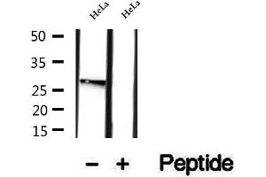 Western blot analysis of extracts of HeLa cells, using RAB12 antibody. (RAB12 抗体  (C-Term))