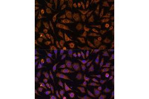 Immunofluorescence analysis of L929 cells using RA antibody (ABIN7269797) at dilution of 1:100. (RAB1A 抗体  (AA 1-100))