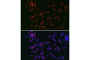 Immunofluorescence analysis of Jurkat cells using TLR6 Rabbit pAb (ABIN7270847) at dilution of 1:150 (40x lens). (TLR6 抗体  (AA 32-200))