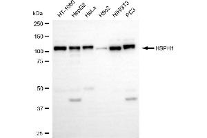 anti-Heat Shock 105kDa/110kDa Protein 1 (HSPH1) antibody