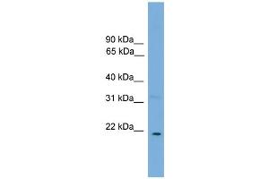 WB Suggested Anti-CTF1 Antibody Titration: 0. (Cardiotrophin 1 抗体  (N-Term))