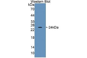 Western blot analysis of the recombinant protein. (PTPRA 抗体  (AA 624-800))