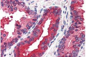 Human Prostate (formalin-fixed, paraffin-embedded) stained with EIF2AK2 antibody ABIN214488 at 2. (EIF2AK2 抗体  (C-Term))
