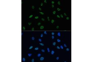 Immunofluorescence analysis of U-2 OS cells using MKL1 Polyclonal Antibody (ABIN6132380, ABIN6143855, ABIN6143858 and ABIN6224589) at dilution of 1:100 (40x lens). (MKL1 抗体  (AA 1-280))