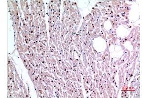 Immunohistochemistry (IHC) analysis of paraffin-embedded Human Heart, antibody was diluted at 1:100. (XRCC6 抗体  (Ser404))