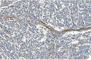 IHC analysis of Filamin A/FLNA using anti-Filamin A/FLNA antibody (ABIN7601783).