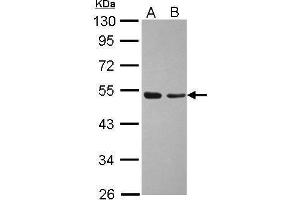 WB Image Sample (30 ug of whole cell lysate) A: A431 B: Jurkat 10% SDS PAGE antibody diluted at 1:1000 (TAF7 抗体  (Center))