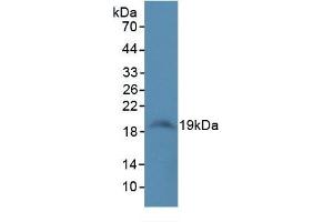 WB of Protein Standard: different control antibody against Highly purified E.