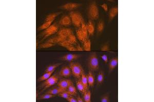 Immunofluorescence (IF) image for anti-Activin A Receptor Type II-Like 1 (ACVRL1) antibody (ABIN7265412)