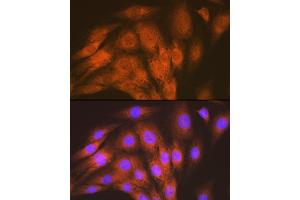Immunofluorescence analysis of C6 cells using  Rabbit mAb (ABIN7265412) at dilution of 1:100 (40x lens). (ACVRL1 抗体)