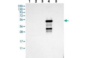 Western blot analysis of Lane 1: RT-4, Lane 2: U-251 MG, Lane 3: Human Plasma, Lane 4: Liver, Lane 5: Tonsil with CYP2C19 polyclonal antibody . (CYP2C9 抗体)