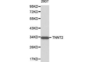 Western blot analysis of 293T cell lysate using TNNT2 antibody. (Cardiac Troponin T2 抗体  (AA 1-120))