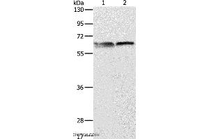 Western blot analysis of 293T and Jurkat cell, using ALAS2 Polyclonal Antibody at dilution of 1:1000 (ALAS2 抗体)