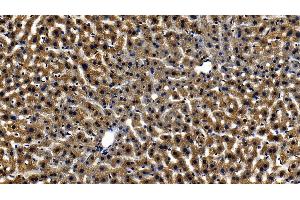 Immunohistochemistry (IHC) image for anti-Toll-Like Receptor Adaptor Molecule 1 (TICAM1) (AA 443-685) antibody (ABIN7441424)