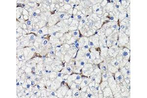 Immunohistochemistry of paraffin-embedded Human liver using COMP Polyclonal Antibody at dilution of 1:100 (40x lens). (COMP 抗体)