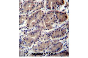 Immunohistochemistry (Paraffin-embedded Sections) (IHC (p)) image for anti-Ring Finger Protein 5, E3 Ubiquitin Protein Ligase (RNF5) (AA 65-94) antibody (ABIN656373)