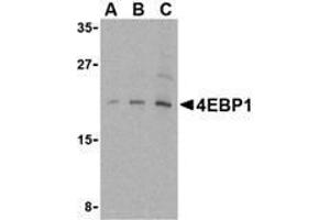 Western blot analysis of AP30001PU-N 4E-BP1 antibody in 3T3 cell lysate with 4E-BP1 antibody at (A) 2. (eIF4EBP1 抗体  (C-Term))
