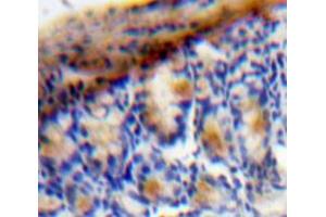 Used in DAB staining on fromalin fixed paraffin-embedded Bowels tissue (VEGFC 抗体  (AA 47-413))