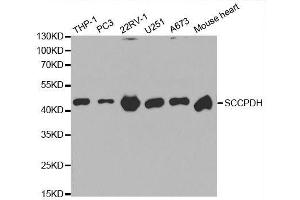 Western blot analysis of extracts of various cell lines, using SCCPDH antibody. (SCCPDH 抗体  (AA 1-270))