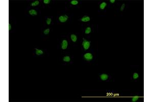 Immunofluorescence of monoclonal antibody to CSE1L on HeLa cell. (Exportin 2 抗体  (AA 872-971))