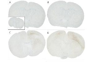 Immunohistochemistry analysis using Mouse Anti-Alpha Synuclein pSer129 Monoclonal Antibody, Clone J18 (ABIN6932879). (SNCA 抗体  (pSer129) (HRP))