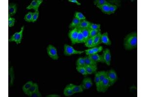 Immunofluorescence staining of HepG2 cells with ABIN7161195 at 1:266, counter-stained with DAPI. (NCAM2 抗体  (AA 209-333))