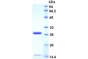 SDS-PAGE analysis of Human Ki-67 Protein. (Ki-67 蛋白)