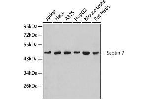 Western blot analysis of extracts of various cell lines, using Septin 7 antibody (ABIN1682655, ABIN3018092, ABIN3018093 and ABIN6220357). (7-Sep (AA 307-436) 抗体)