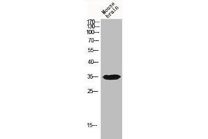 Western Blot analysis of MOUSE-BRAIN cells using IGFBP3 Polyclonal Antibody (IGFBP3 抗体)