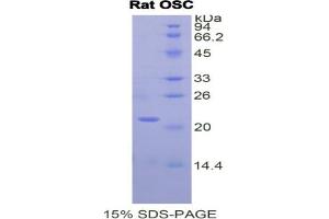 SDS-PAGE analysis of Rat Oxidosqualene Cyclase Protein. (LSS 蛋白)