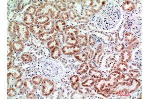 Immunohistochemistry (IHC) image for anti-Egf-Like Module Containing, Mucin-Like, Hormone Receptor-Like 2 (EMR2) (Internal Region) antibody (ABIN6284181)