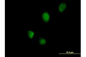 Immunofluorescence of purified MaxPab antibody to RNF113B on HeLa cell. (RNF113B 抗体  (AA 1-322))