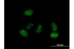 Immunofluorescence of purified MaxPab antibody to ALS2CR15 on HeLa cell. (ICA1L 抗体  (AA 1-482))
