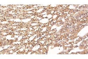 Immunohistochemistry (IHC) image for anti-Clusterin (CLU) (AA 226-447) antibody (ABIN7426742)