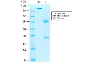 SDS-PAGE Analysis of Purified AIF1/IBA1 Mouse Recombinant Monoclonal Antibody ABIN6383787. (Recombinant Iba1 抗体)