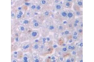IHC-P analysis of Mouse Tissue, with DAB staining. (TXK 抗体  (AA 286-509))