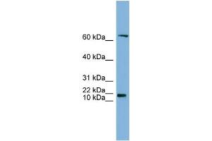 WB Suggested Anti-GM2A Antibody Titration:  0. (GM2A 抗体  (N-Term))