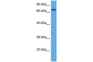Western Blotting (WB) image for anti-SRY (Sex Determining Region Y)-Box 5 (SOX5) (C-Term) antibody (ABIN2777862)