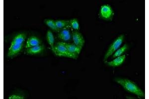 Immunofluorescence (IF) image for anti-Protein Kinase, CAMP-Dependent, Regulatory, Type II, alpha (PRKAR2A) (AA 43-205), (Regulatory Subunit) antibody (ABIN7146620)