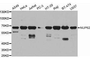 Western blot analysis of extracts of various cell lines, using NUP62 antibody (ABIN5971334) at 1/1000 dilution. (NUP62 抗体)