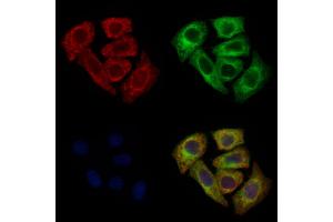 ABIN6260562 and ABIN6272683 staining Hela cells by IF/ICC. (CCR8 抗体  (C-Term))